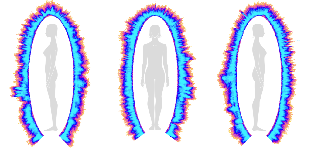 GDV slika po Kozmoterapiji